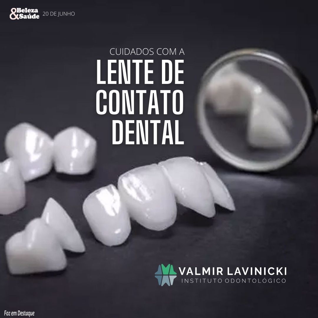 CUIDADOS COM A LENTE DE CONTATO DENTAL bs-lavinicki-1-2