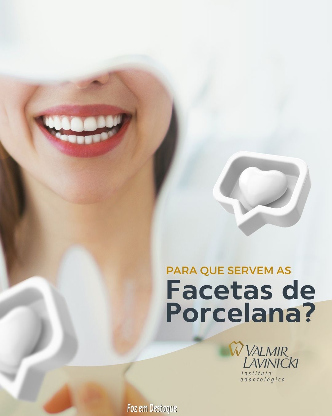 Para que servem as Facetas de Porcelana? bs-lavinicki-2