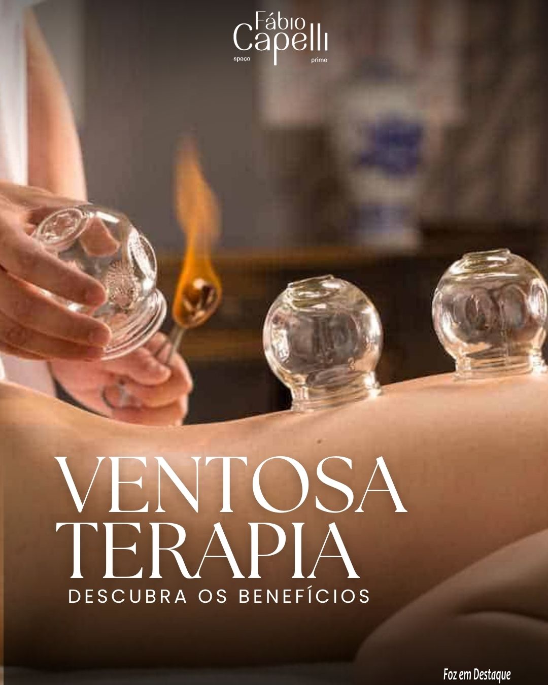 Descubra os Benefícios da Ventosaterapia no Spaço Fábio Capelli! bs-capelli-1