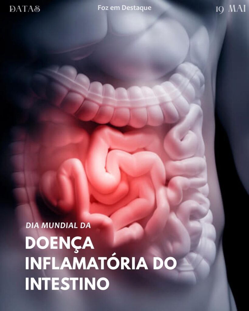 Dia Mundial da Doença Inflamatória do Intestino (DII)
Foz em Destaque "Sua Vida mais divertida".