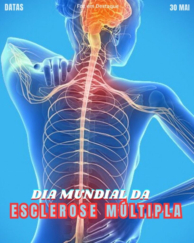 Dia Mundial da Esclerose Múltipla
Datas 30 de maio 2025 Foz em Destaque "Sua Vida mais divertida". Conheça a relevância e celebre as datas comemorativas de hoje.