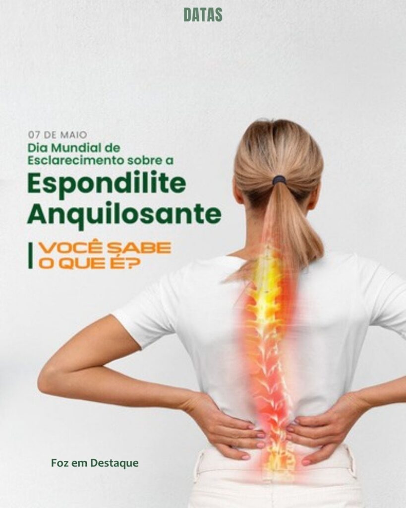 Dia Mundial da Espondilite Anquilosante
Datas 07 de maio 2025 Foz em Destaque "Sua Vida mais divertida