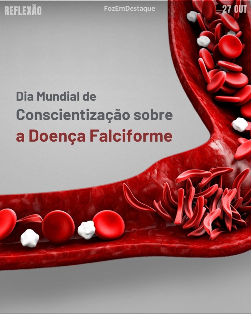 Dia Nacional de Luta pelos Direitos das Pessoas com Doenças Falciformes
Datas Comemorativas 27 Outubro
FozEmDestaque
#suavidamaisdivertida